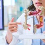 Câncer colorretal: informação e prevenção são aliados no diagnóstico precoce